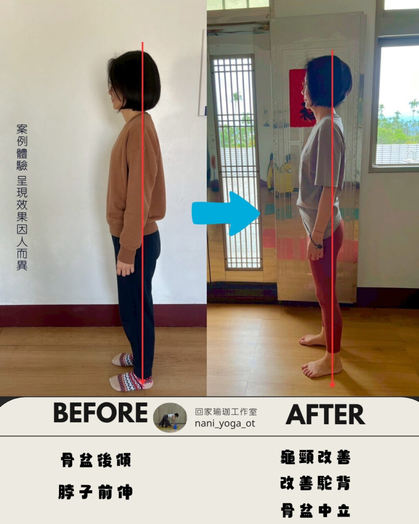 IG體態調整前後對照圖 (2)