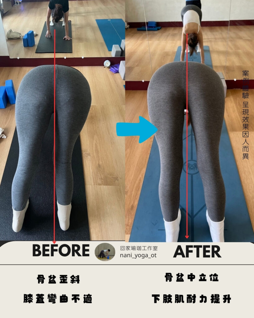 IG體態調整前後對照圖 (3)