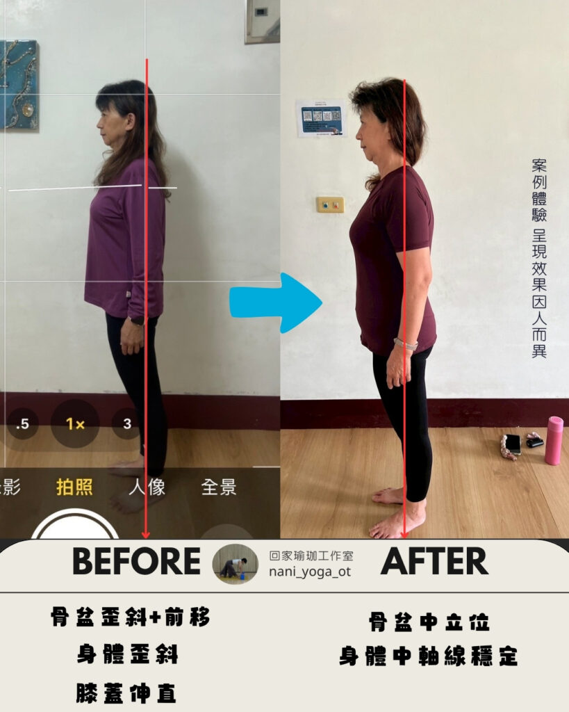 IG體態調整前後對照圖 (4)