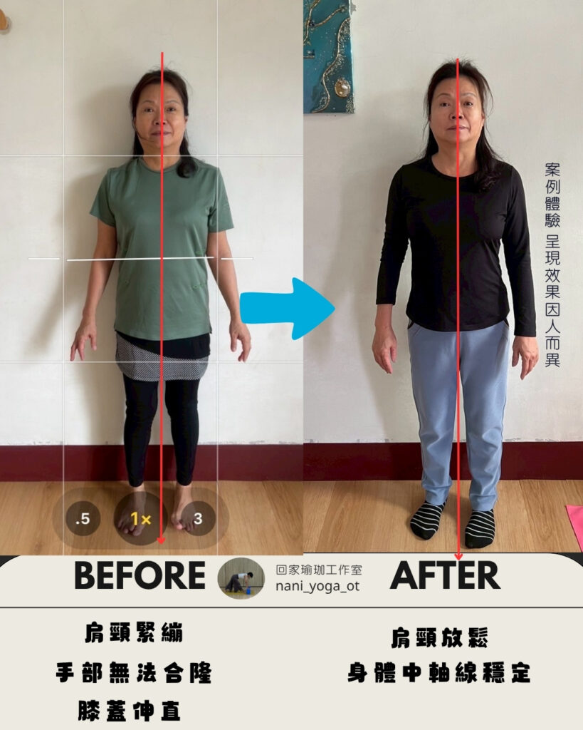 IG體態調整前後對照圖 (5)