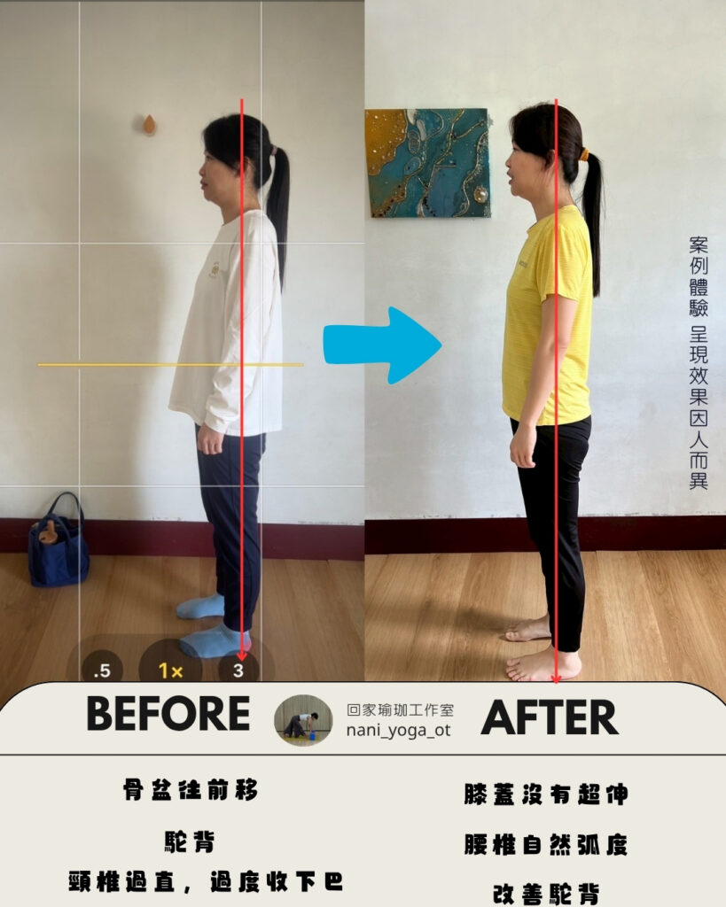 IG體態調整前後對照圖